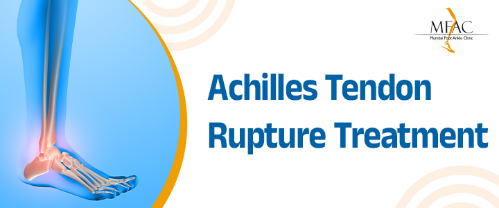 Achilles Tendon Rupture Treatment