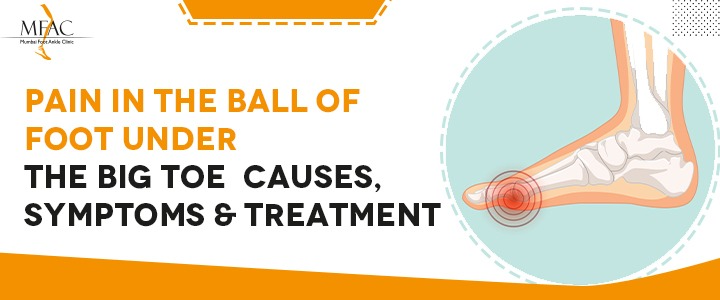 Ball of Foot Pain Treatment in Mumbai | Dr. Pradeep Moonot | MFAC