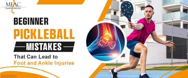 Foot and Ankle Injuries in Beginner Pickleball Players