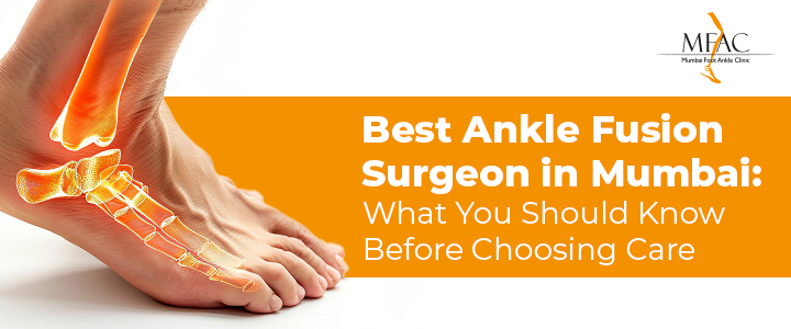 Best Ankle Fusion Surgeon in Mumbai - What You Should Know Before Choosing Care