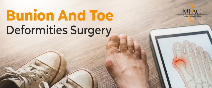 Bunion and Toe Deformities Surgery Guide | Dr Pradeep Moonot