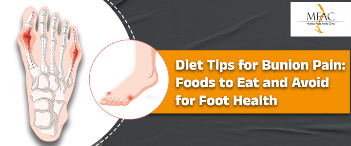 foods to avoid for Bunion Pain | MKFAC | Dr Pradeep Moonot