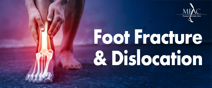 Foot Fracture and Dislocation | Dr. Pradeep Moonot