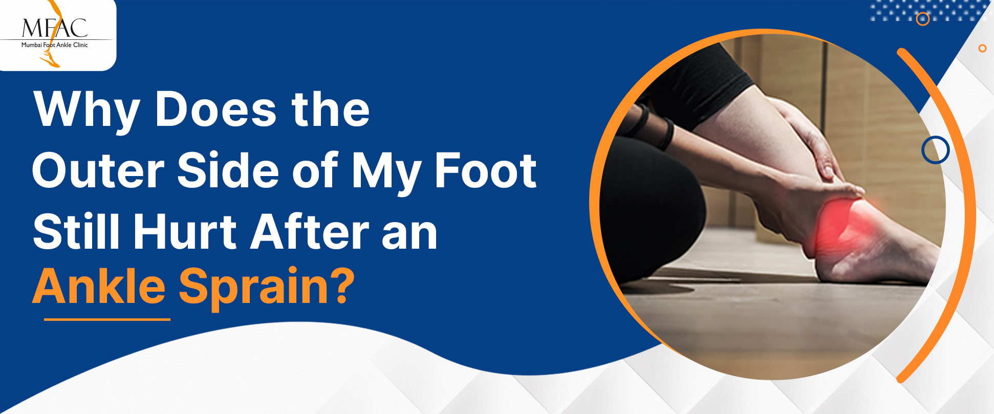 Person experiencing persistent pain on the outer side of the foot after an ankle sprain.