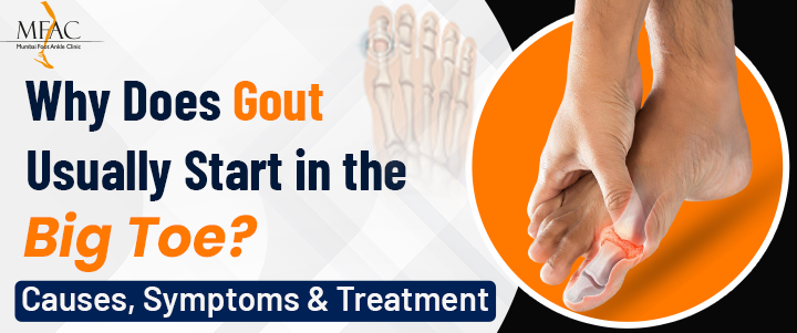 Why does gout usually start in the big toe? Causes, symptoms and treatment | MFAC Clinic in Mumbai