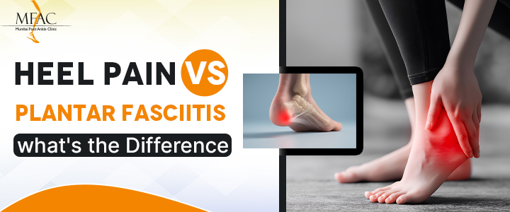Heel pain vs plantar fasciitis symptoms