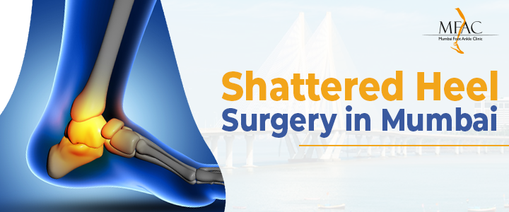 Shattered Heel Surgery in Mumbai