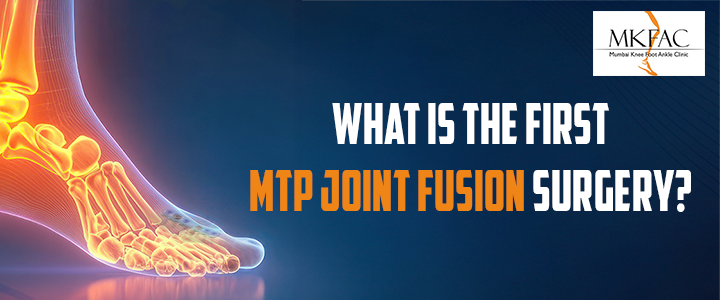 What is the First MTP Joint Fusion Surgery